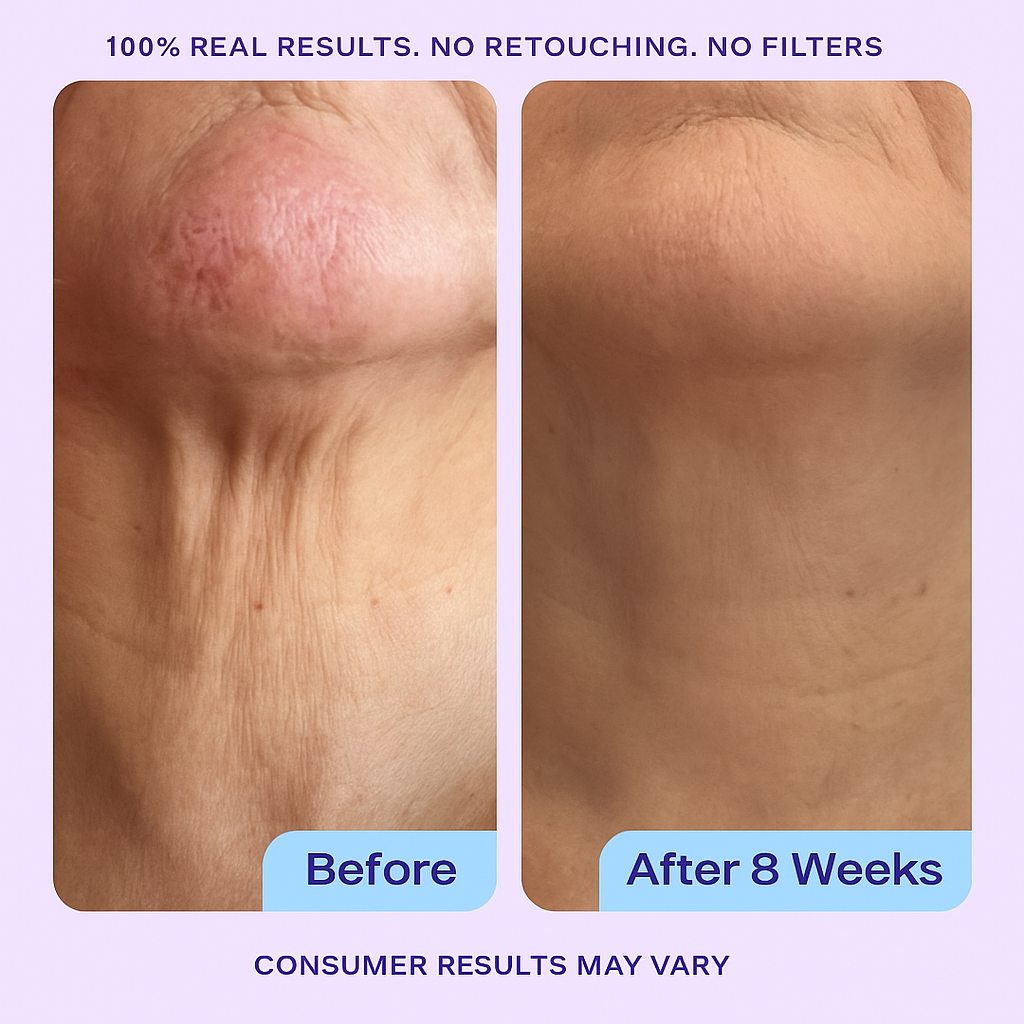 Alleyra Neck Firming Cream